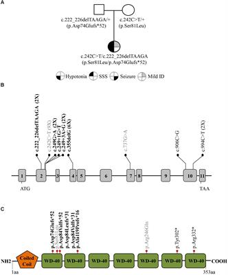 A NGS-Targeted Autism/ID Panel Reveals Compound Heterozygous GNB5 Variants in a Novel Patient